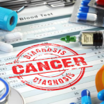 NHS Trust Faces Lawsuit Over Delayed AI-Cancer Diagnoses