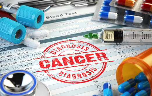 NHS Trust Faces Lawsuit Over Delayed AI-Cancer Diagnoses